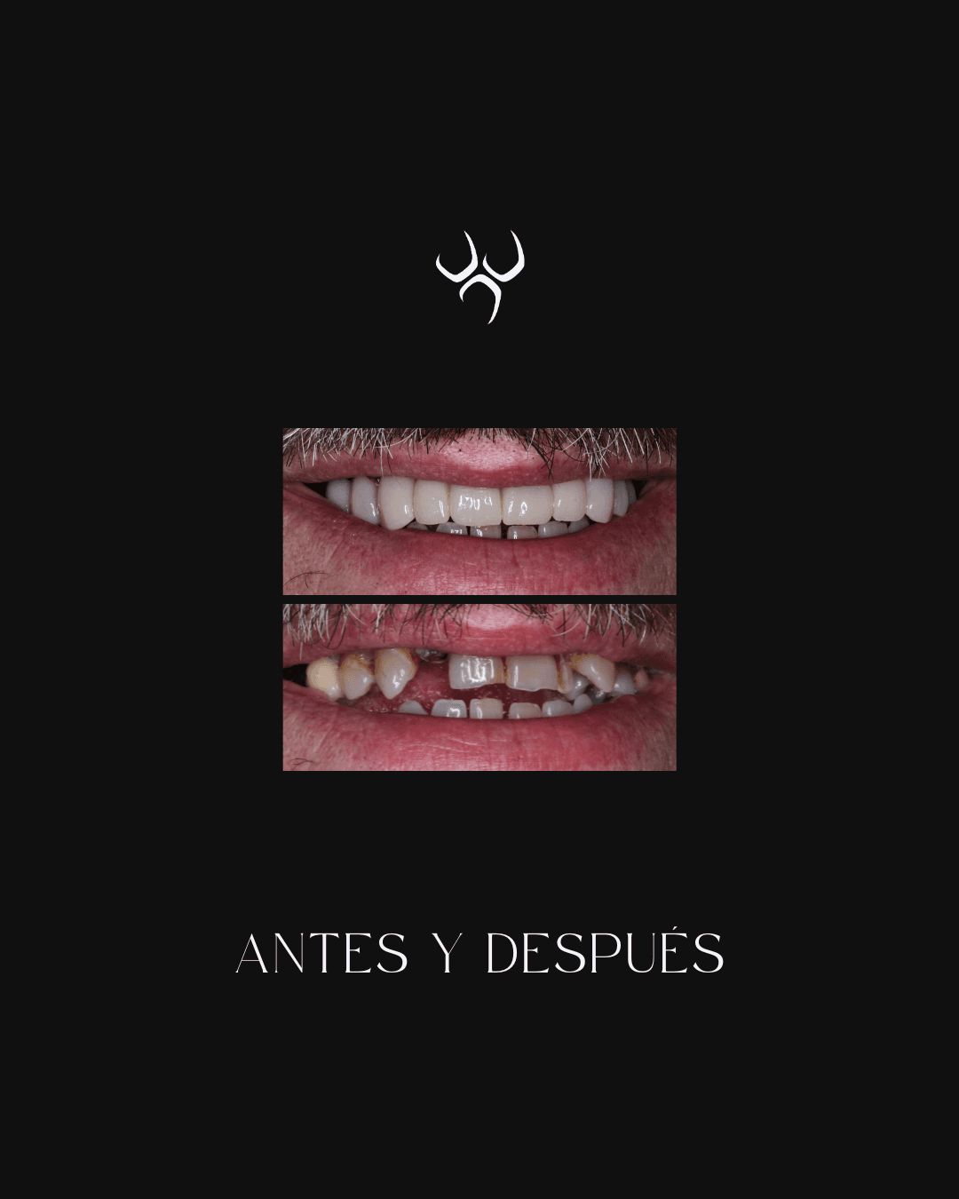 Publicación de antes y después para ILC Dental