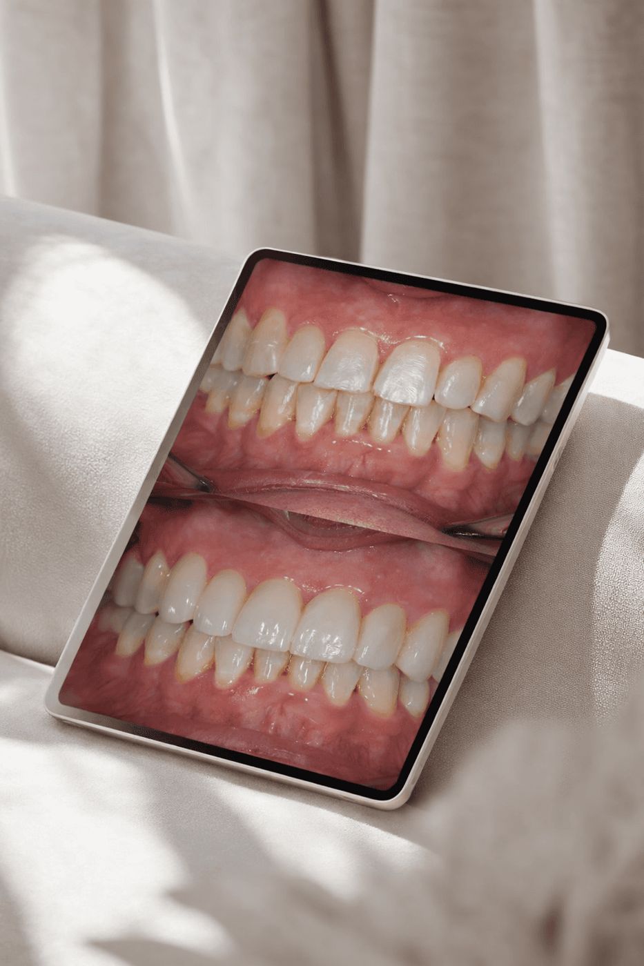 Resultado de tratamiento dental mostrado en tablet para ILC Dental